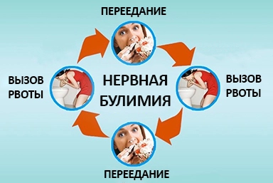 Лечение булимии в Карабулаке